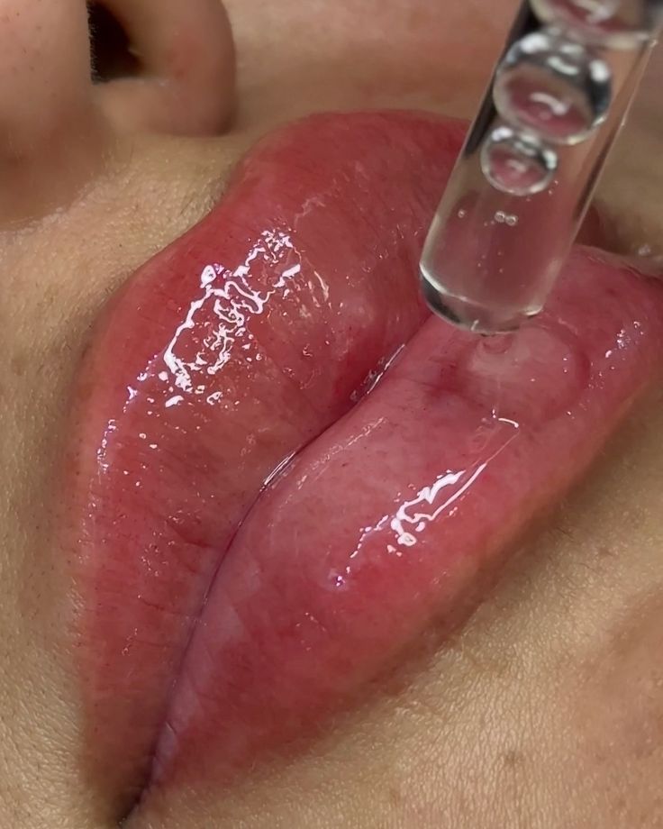 Hidratación labios Ácido Hialurónico