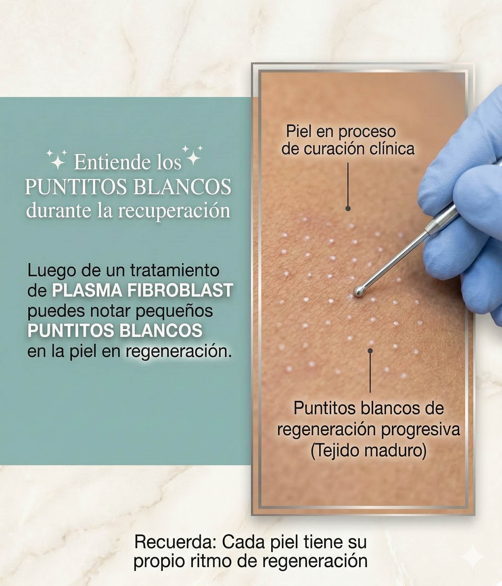 Puntitos blancos durante recuperación de Plasma Fibroblast