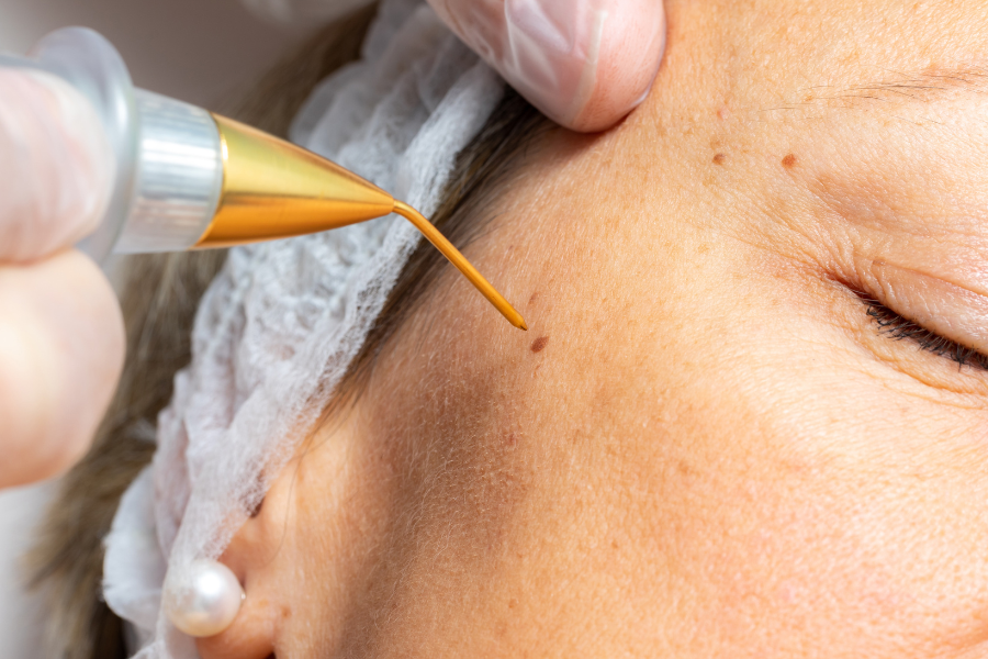 Plasma Fibroblast en Panamá