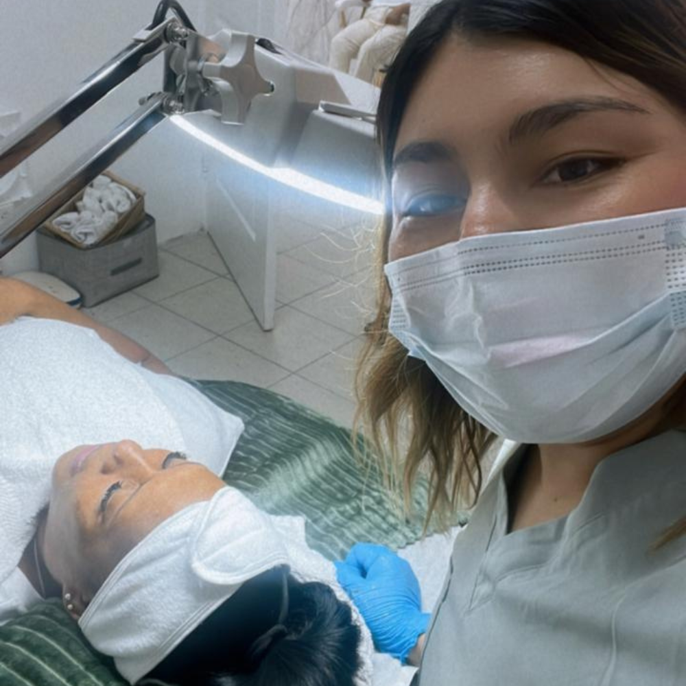 Plasma Fibroblast trabajando en Figura Rostro KG