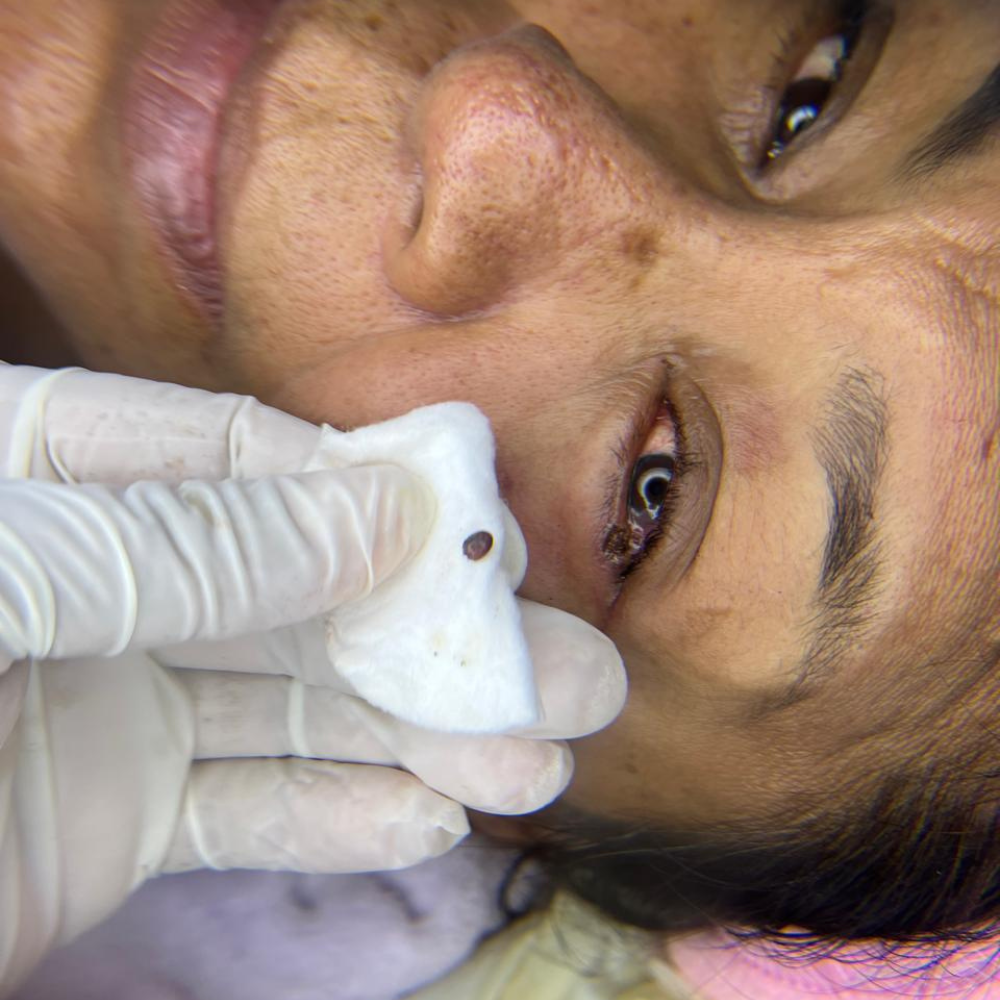 Resultado de tratamiento facial en Figura Rostro KG